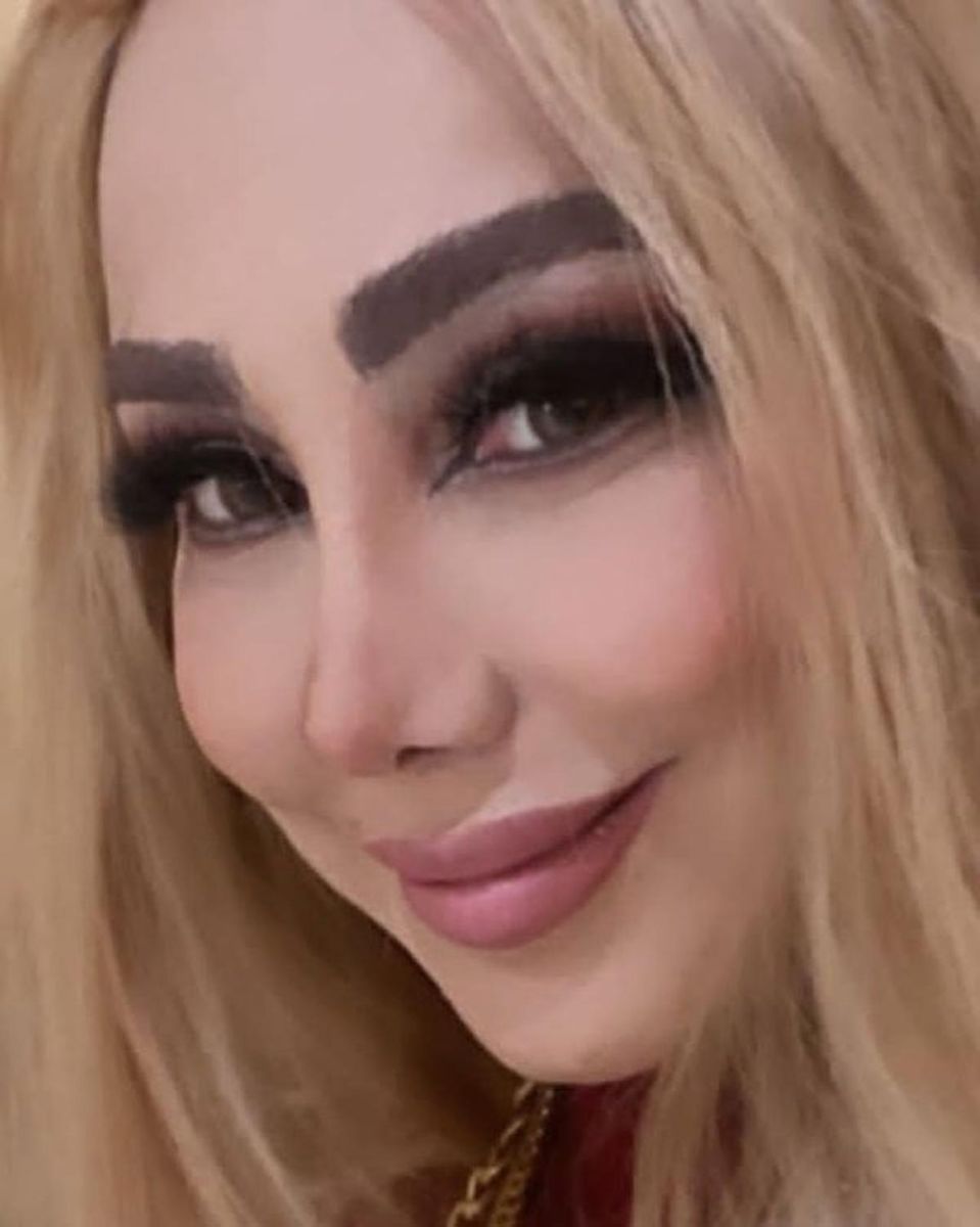 بهنوش بختیاری با عمل زیبایی دنیا جهانبخت شد + عکس