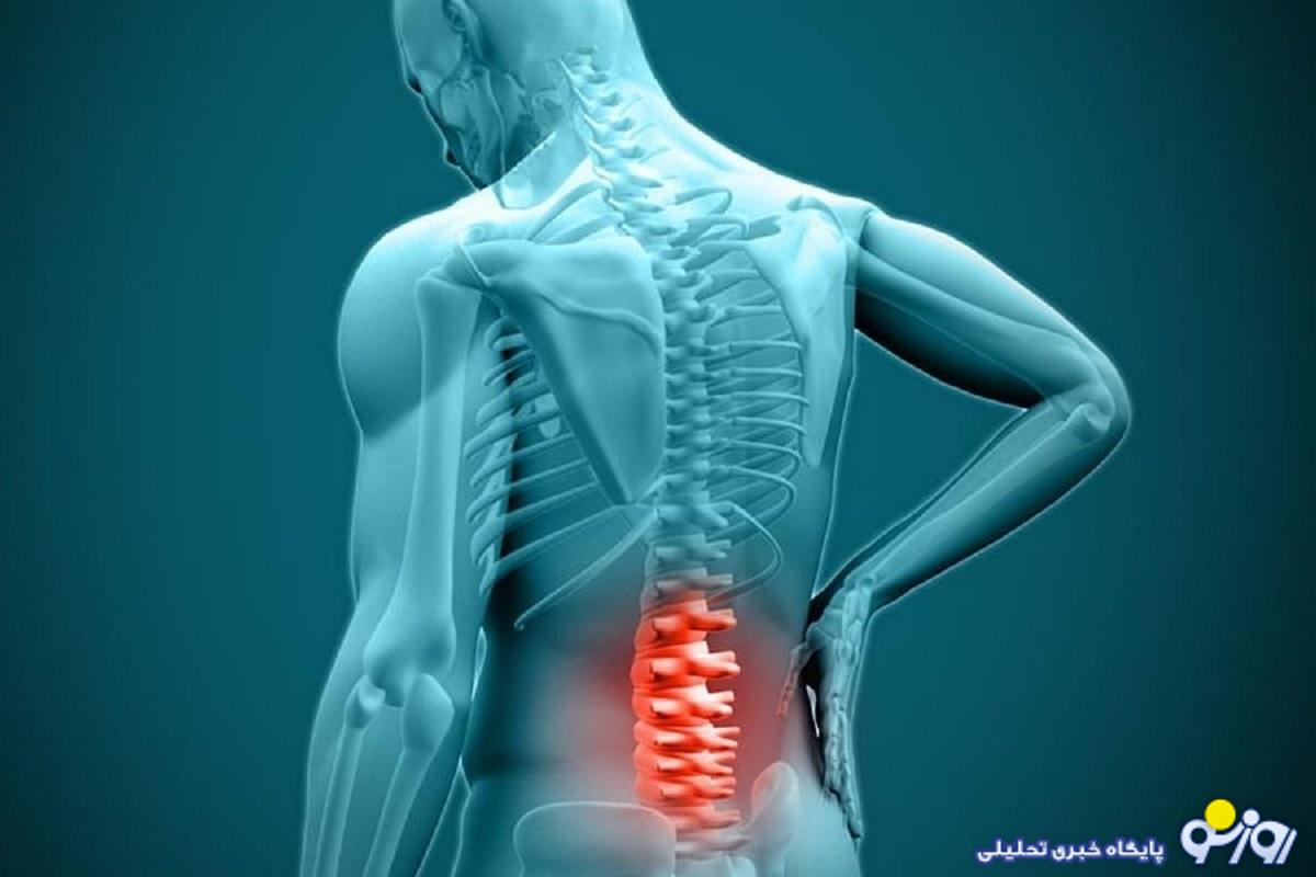 دیسک کمر چیست و چگونه بر زندگی افراد تأثیر می‌گذارد؟